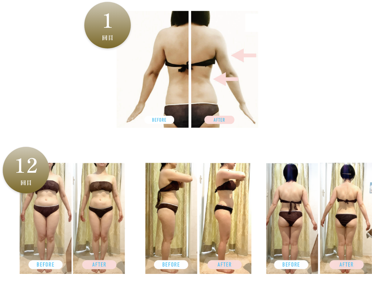 Before & After